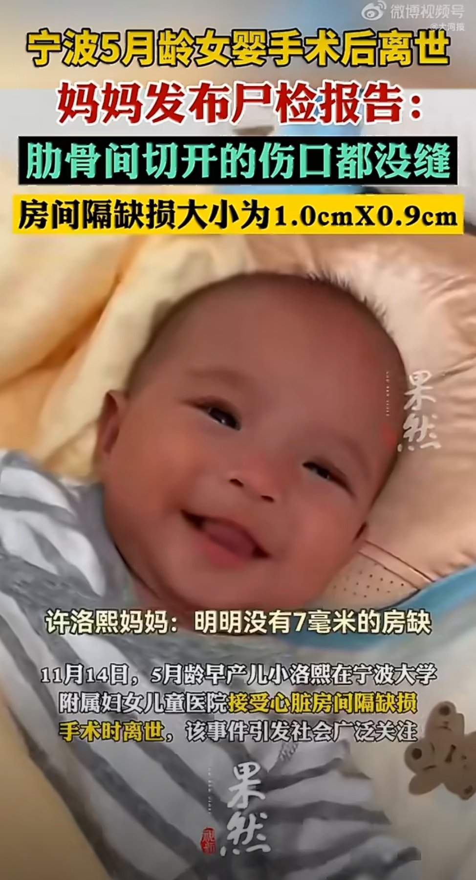 #小洛熙宝宝事件最新进展##专家称小洛熙的房间隔缺损确实存在##小洛熙妈妈# 宁