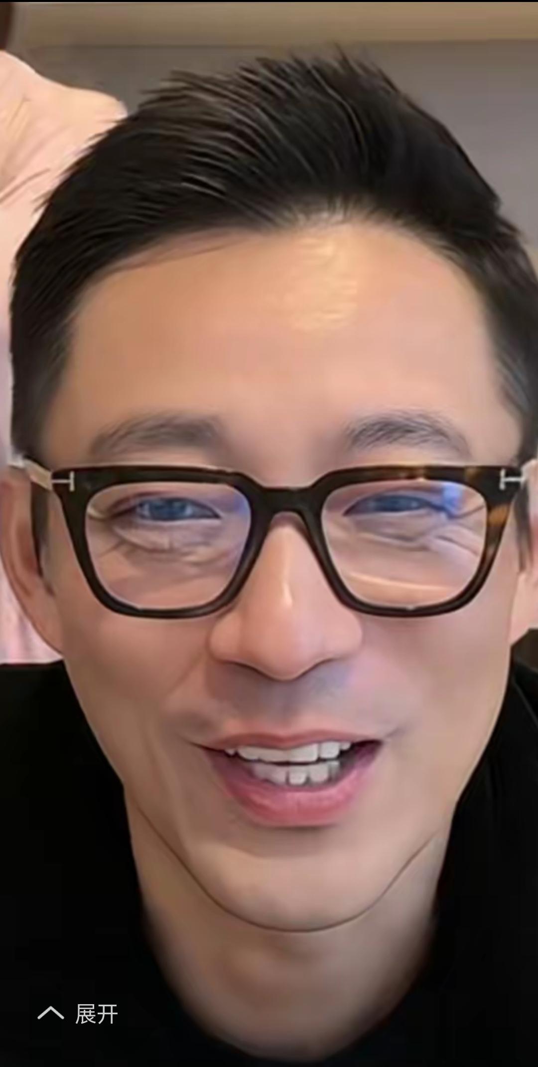 汪小菲的双眼这是怎么了？戴着眼镜都遮不住，也就40多岁吧，不应该这么大皱纹吧？是