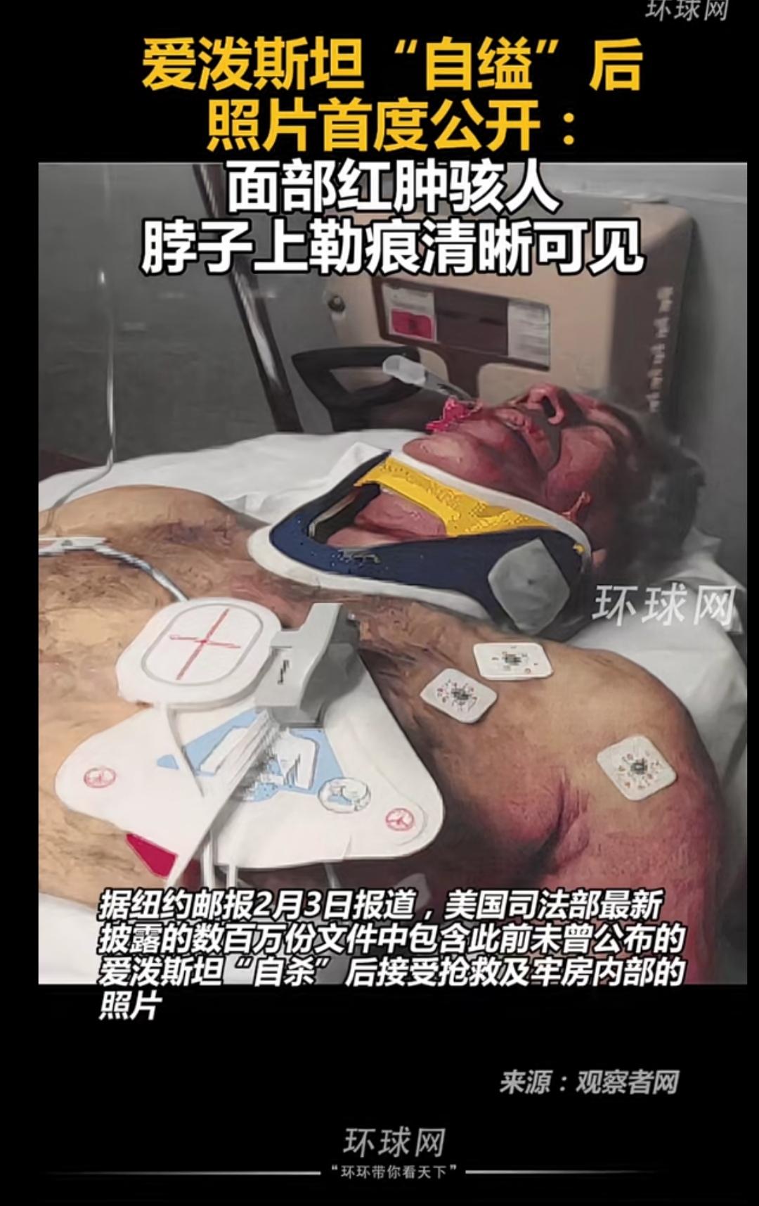 死的疑点重重，背后真正的大佬都上岸了，最终爱泼斯坦扛下了所有，死无对证，真绝！这