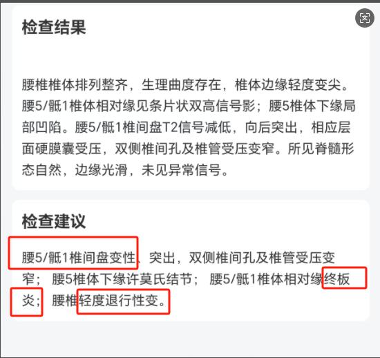 腰椎间盘突出就怕这三个动作！堪称黄金法宝。腰椎间盘突出就怕这三个动作！...