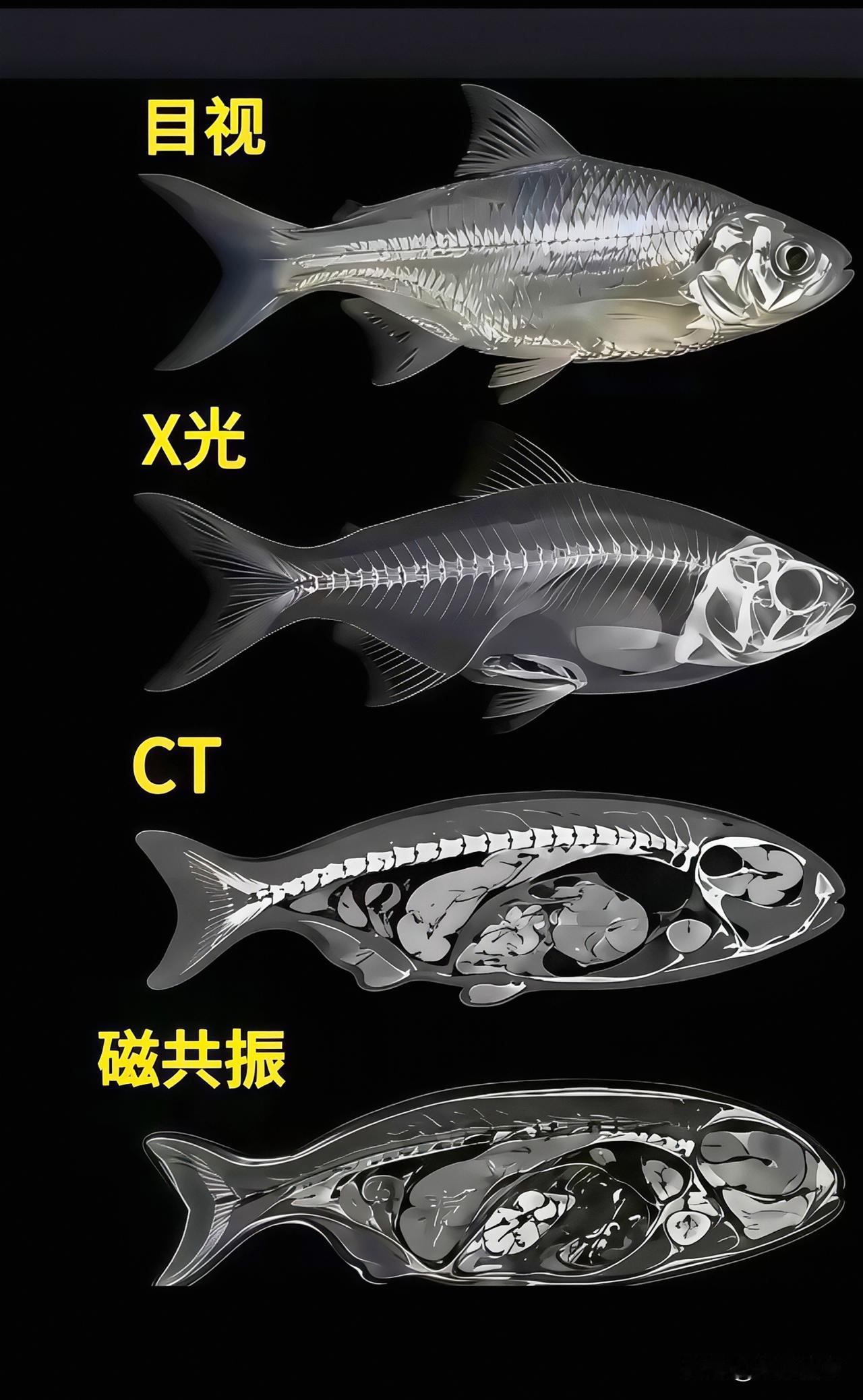 一条小鱼，带你看懂四种检查到底差在哪…
 
大家平时去医院，总会听说X光、CT、