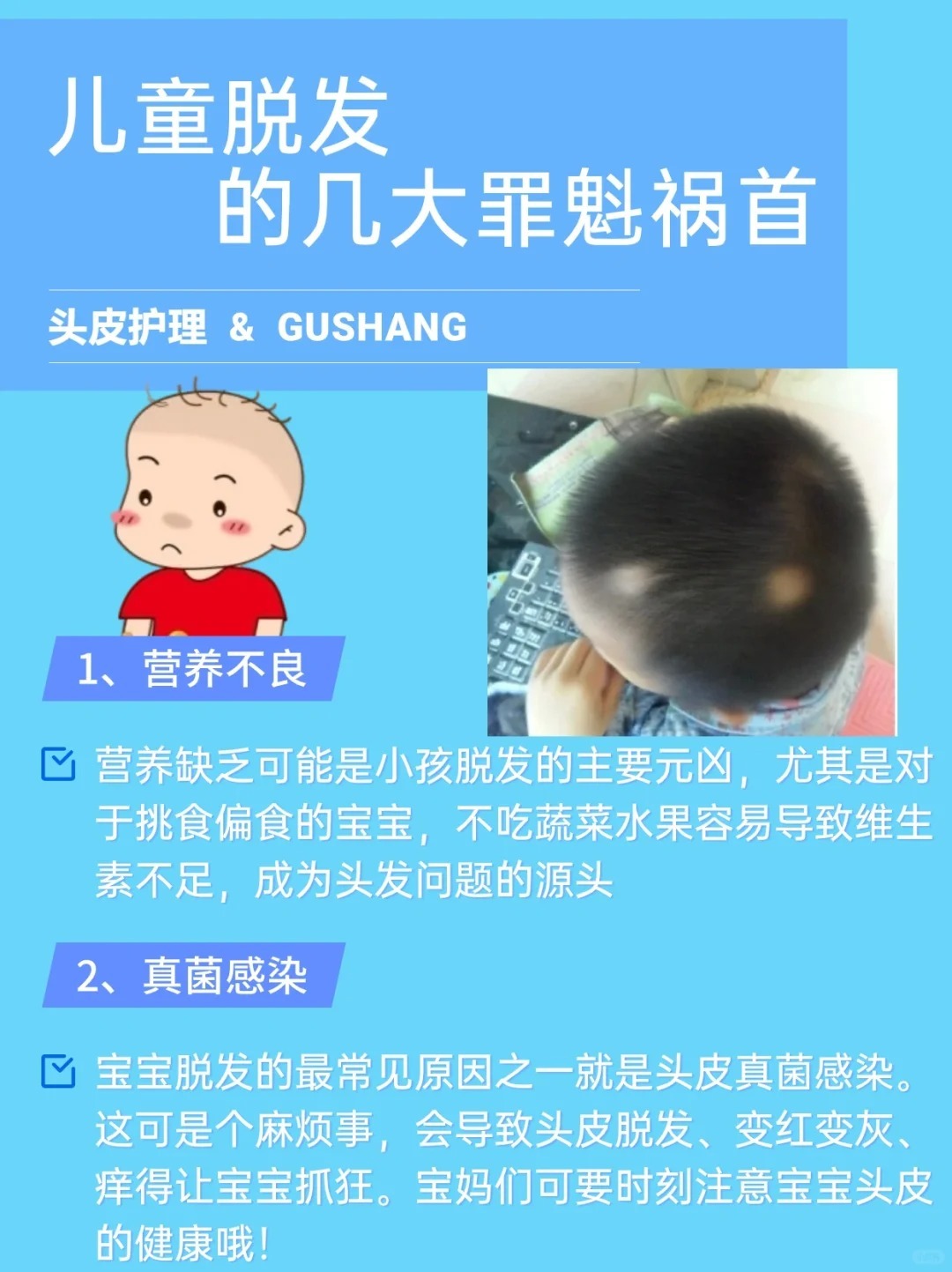 #10后已经开始秃头了# 导致小孩脱发的原因都有哪些？其中造成脱发的因素分为很多