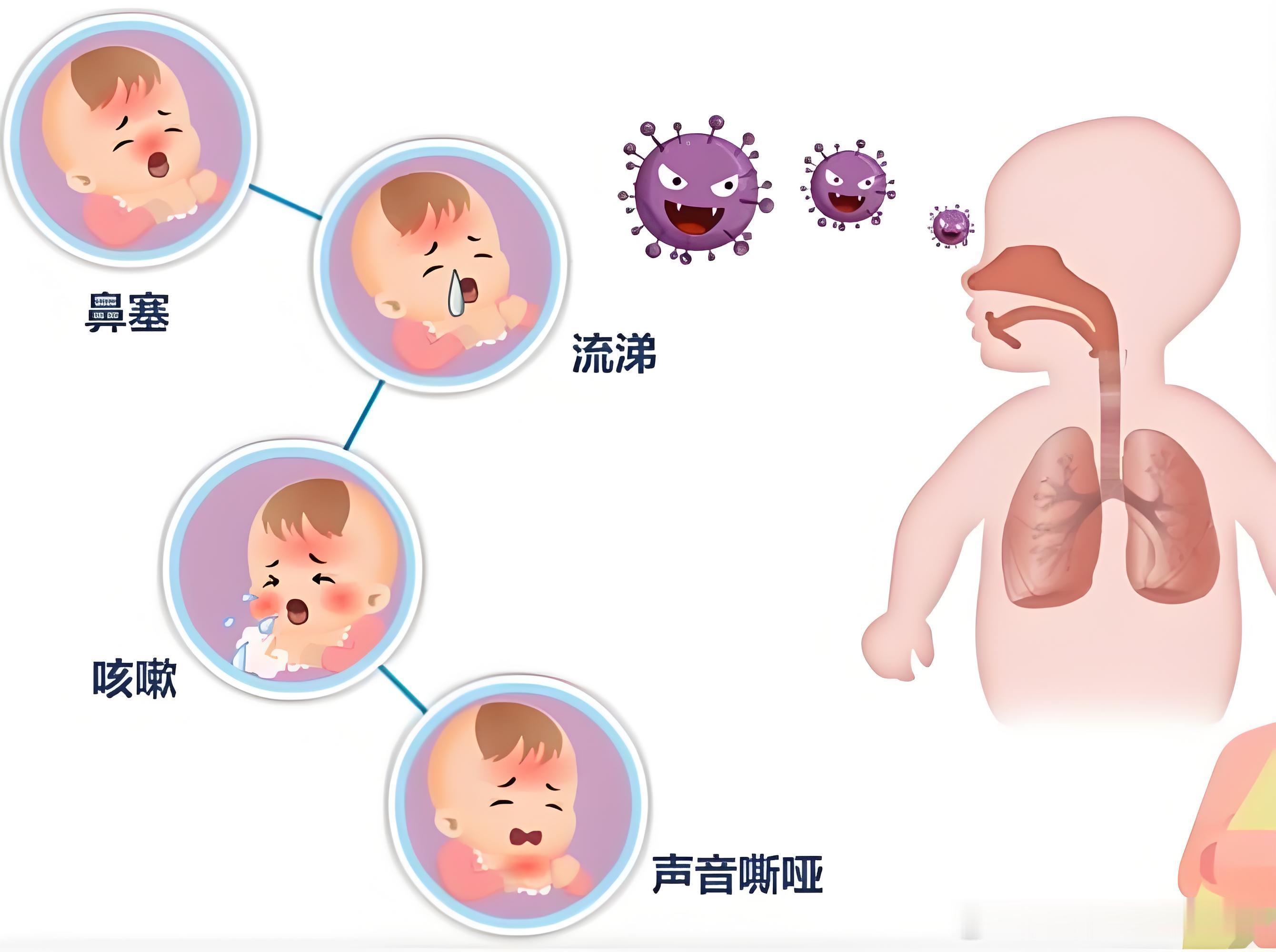 ⚠️秋冬高发｜家长别忽视呼吸道合胞病毒很多家长以为宝宝咳嗽喘息就是感冒，其实有可