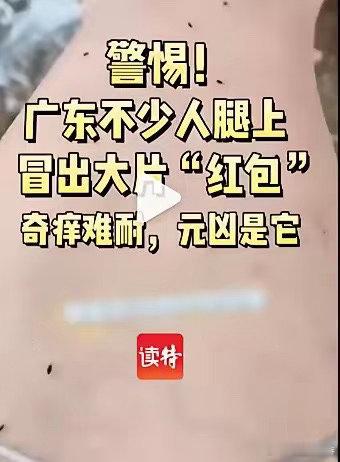 警惕！广东不少人腿上冒出大片“红包”，奇痒难耐，元凶是它近期广东湿热天气持续，一