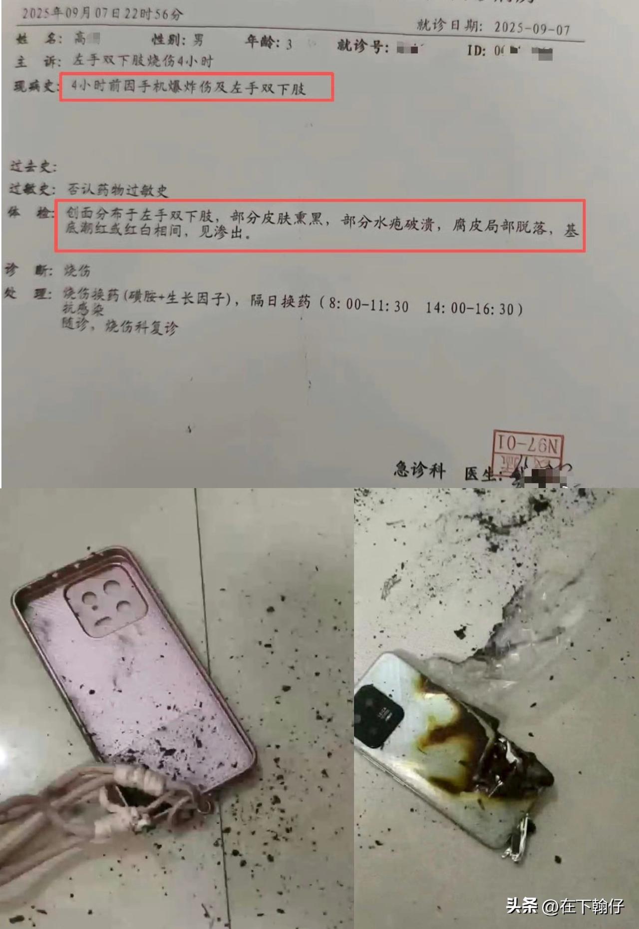 9月7日，江苏徐州一名3岁男童使用小米手机观看视频时，手机突然爆炸并伴随火光及巨