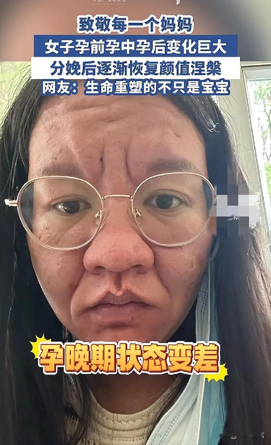昆明一妈妈分享了自己孕前孕后的变化，让很多妈妈感慨万千！

这个位妈妈孕前是一个