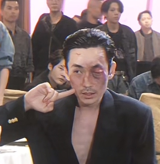 以后我牙疼就这样😂 