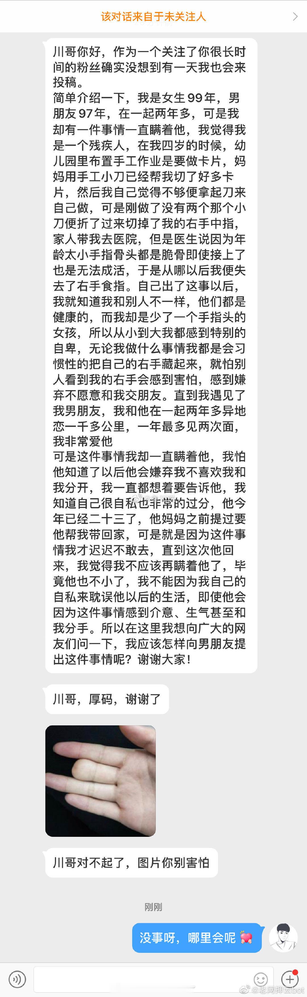 我小时候做事情的时候不小心切到了手指，导致中指丢失现在我出门的时候会把手藏起来，
