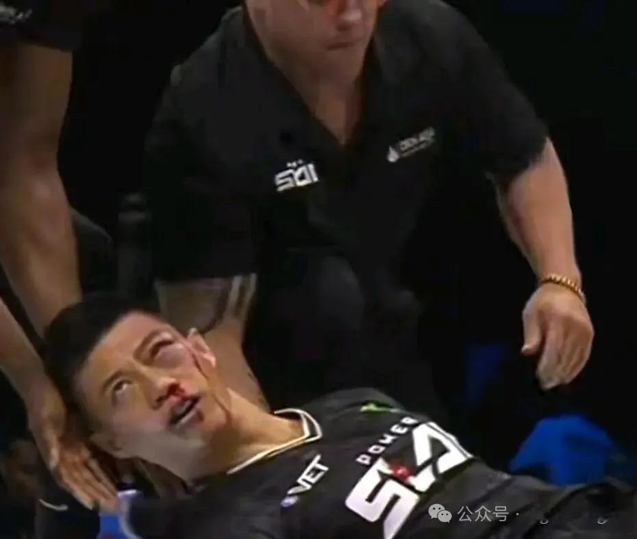 10月31日，通背拳传人赵鸿刚在UFC旗下的Power Slap赛场遭遇惨败。他