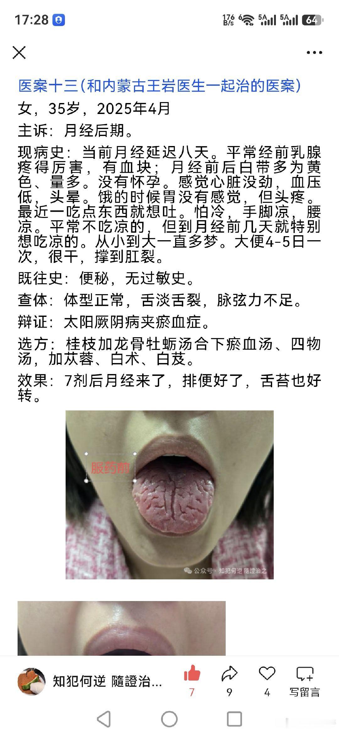 月经延后治疗。 ​​​