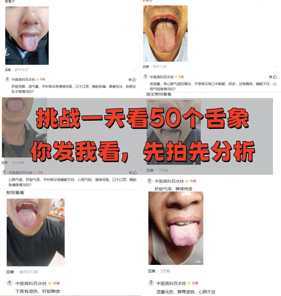 全网舌诊挑战，一天看50个舌象，只要你发我就坚持看！

最近天气降温了，大家注意