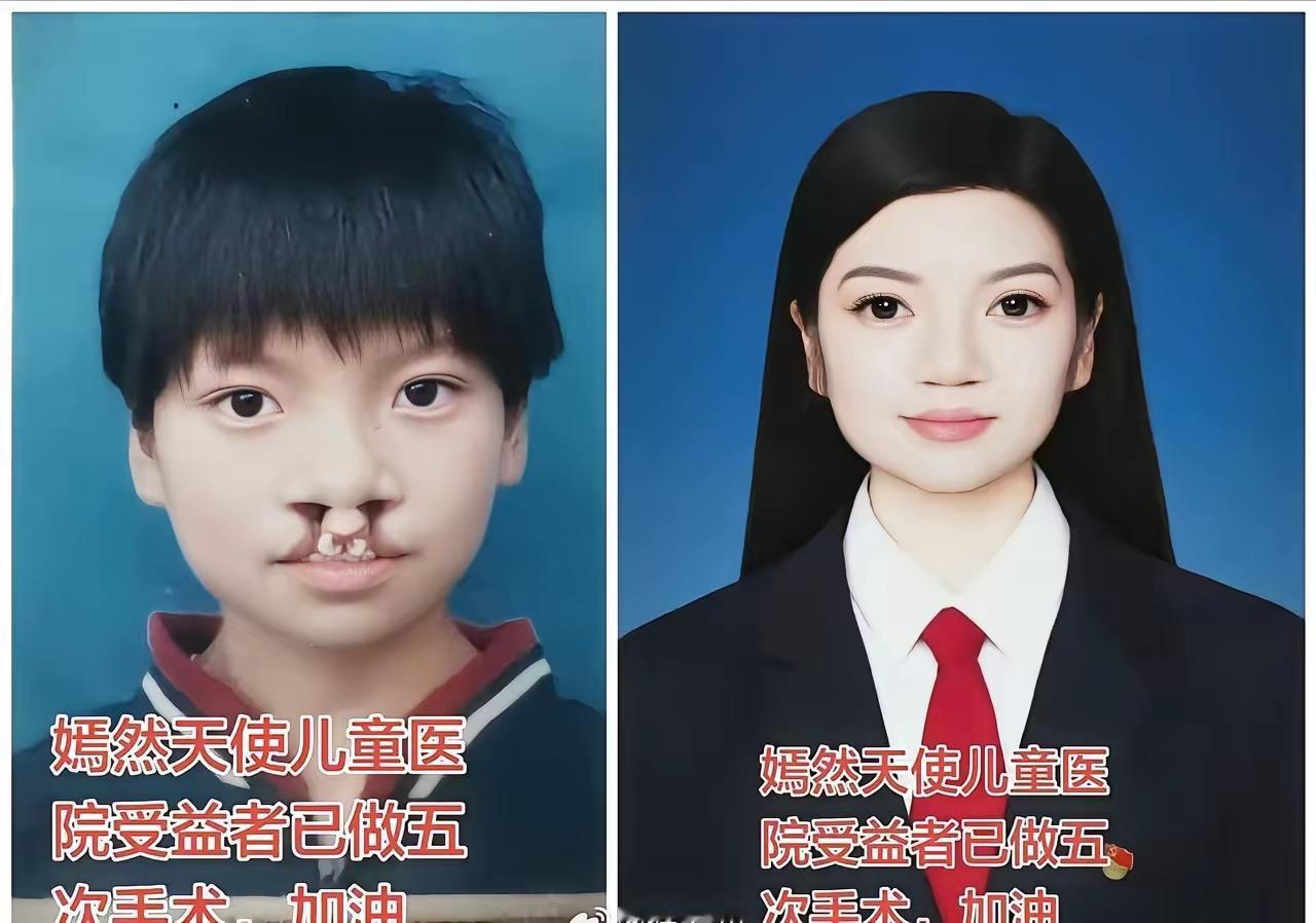 李亚鹏还是有令狐冲的侠义精神，坚守做公益16年，在自身欠债累累情况下也没有放弃，