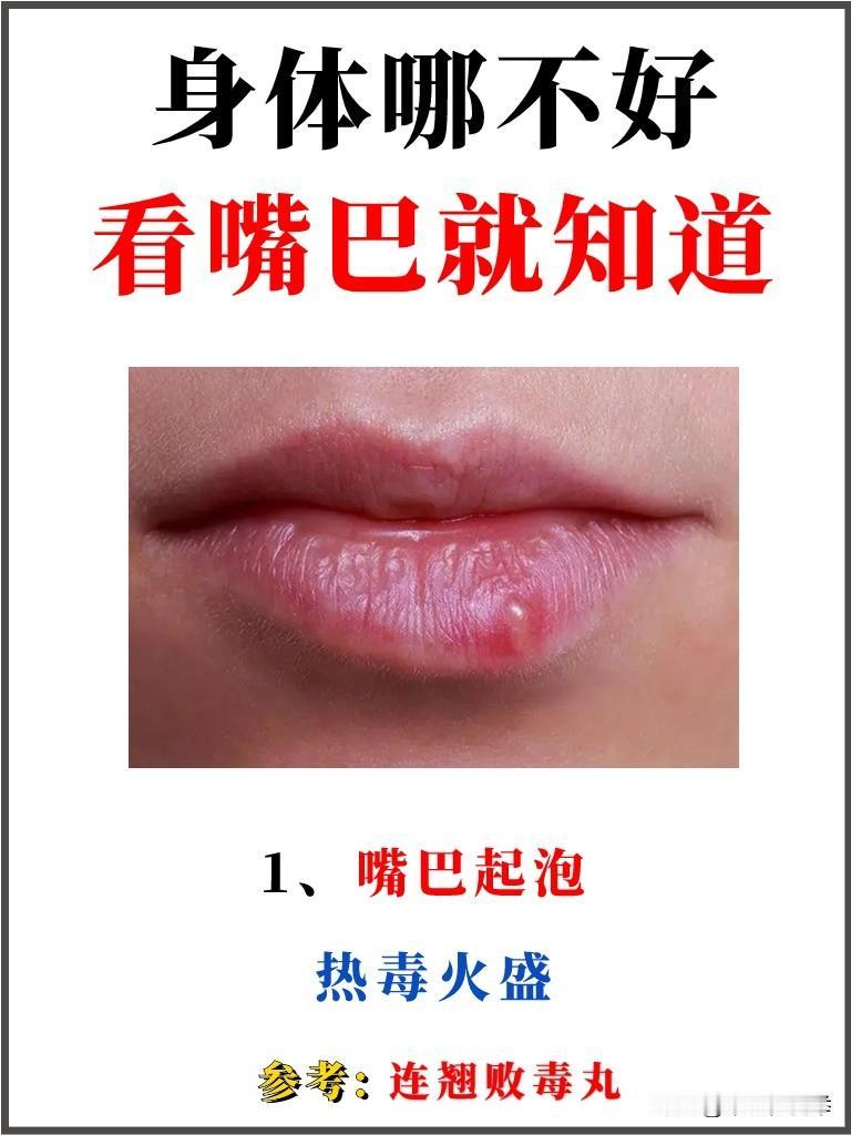 身体不好嘴先知，嘴上这些表现，其实都是脏腑给你的“健康信号”
#中医##养生#