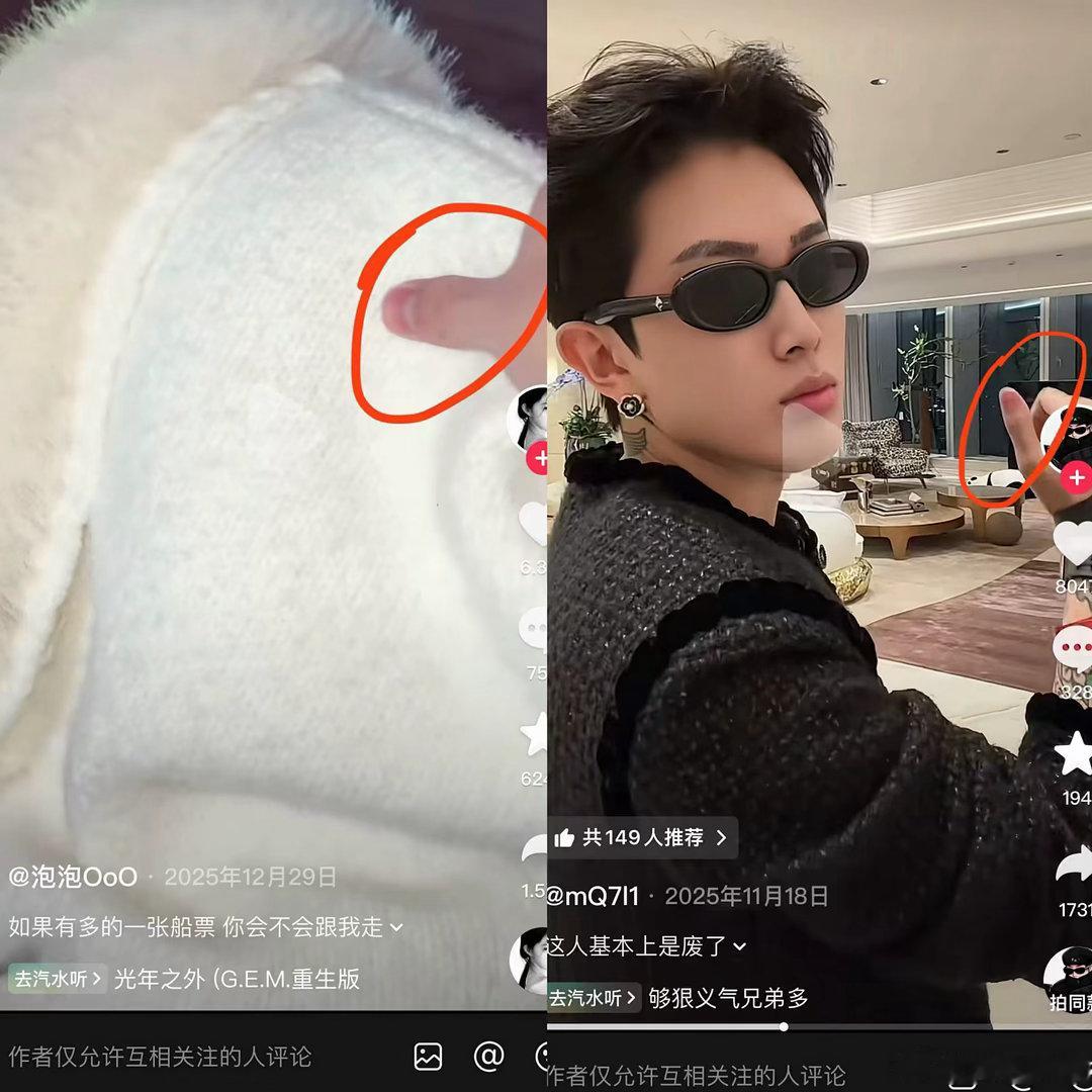 小伊伊 伊伊刚回归直播时，说过“我所承受的，你们未必能扛得过去”终于知道她经历了