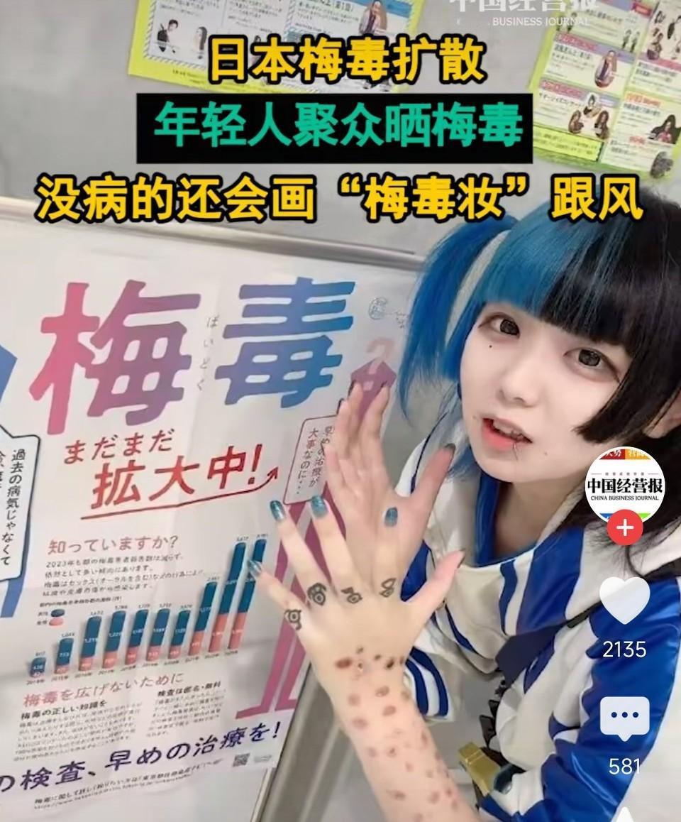 日本梅毒扩散!年轻人聚众晒梅毒！