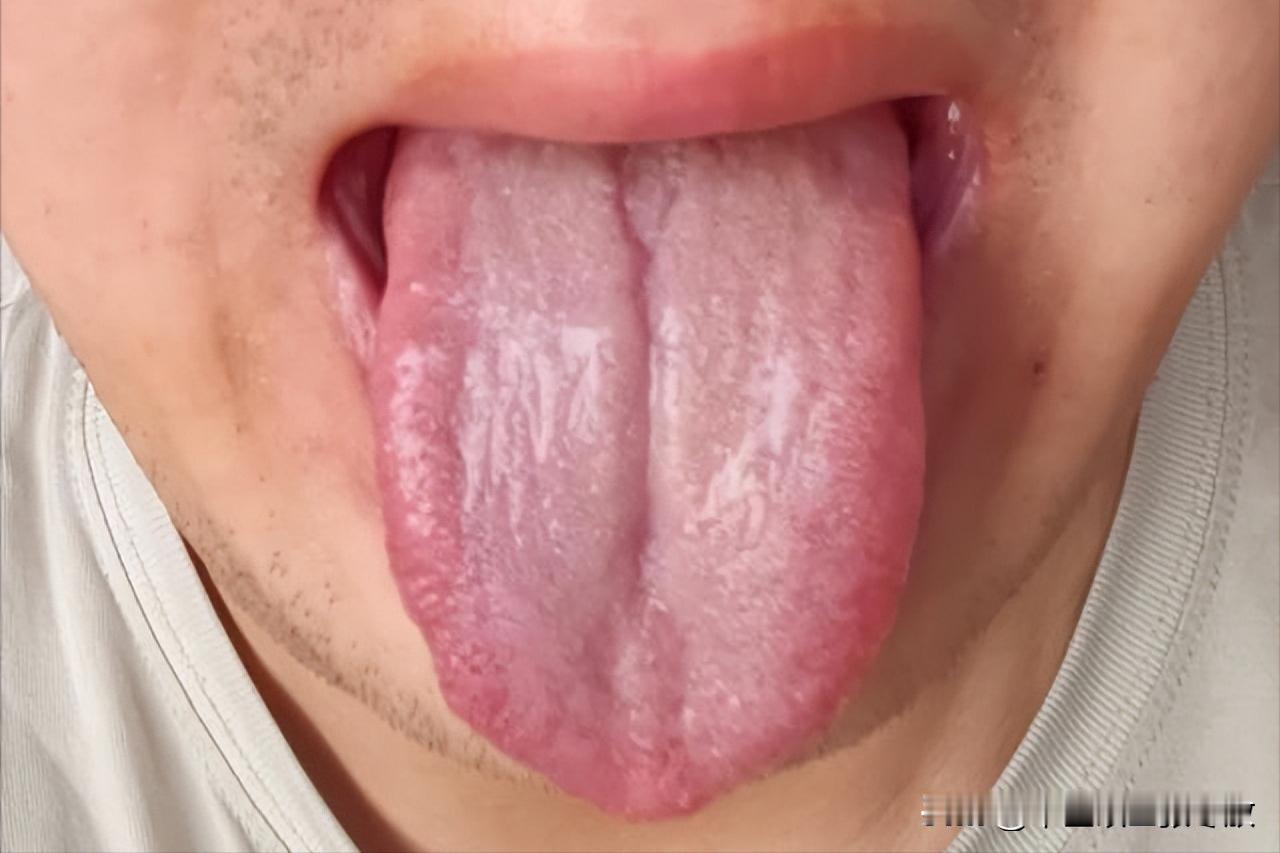 大兄弟你都奔四的人了，裂纹这么深，可别使劲“造”了！[捂脸][捂脸]
主诉：时间