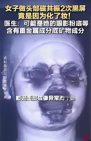 差点解释不清了！福建泉州，一女子头晕去医院检查，没想到，做核磁共振时先后两次出现