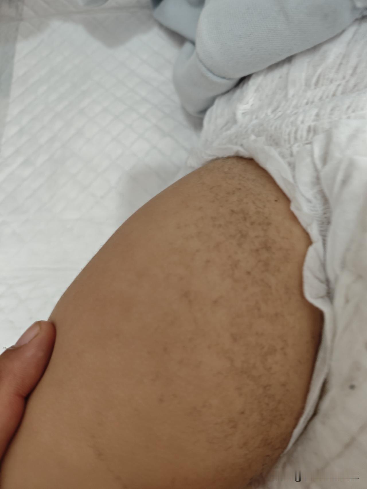 给娃入了条新裤子，掉色掉毛的情况特别严重，才穿了小半天，给娃换尿不湿的时候我吓了
