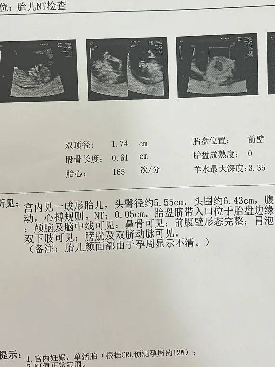 NT秒过的几个小技巧🗣️孕妈妈速来🫄