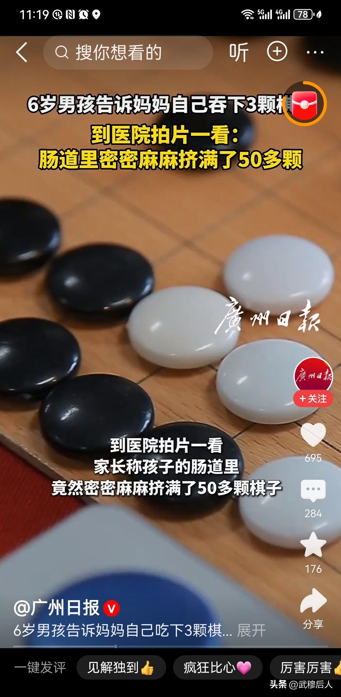 男孩称吞下3颗棋子 检查发现50多颗
 
5月19日，河北廊坊一名6岁男孩告诉妈
