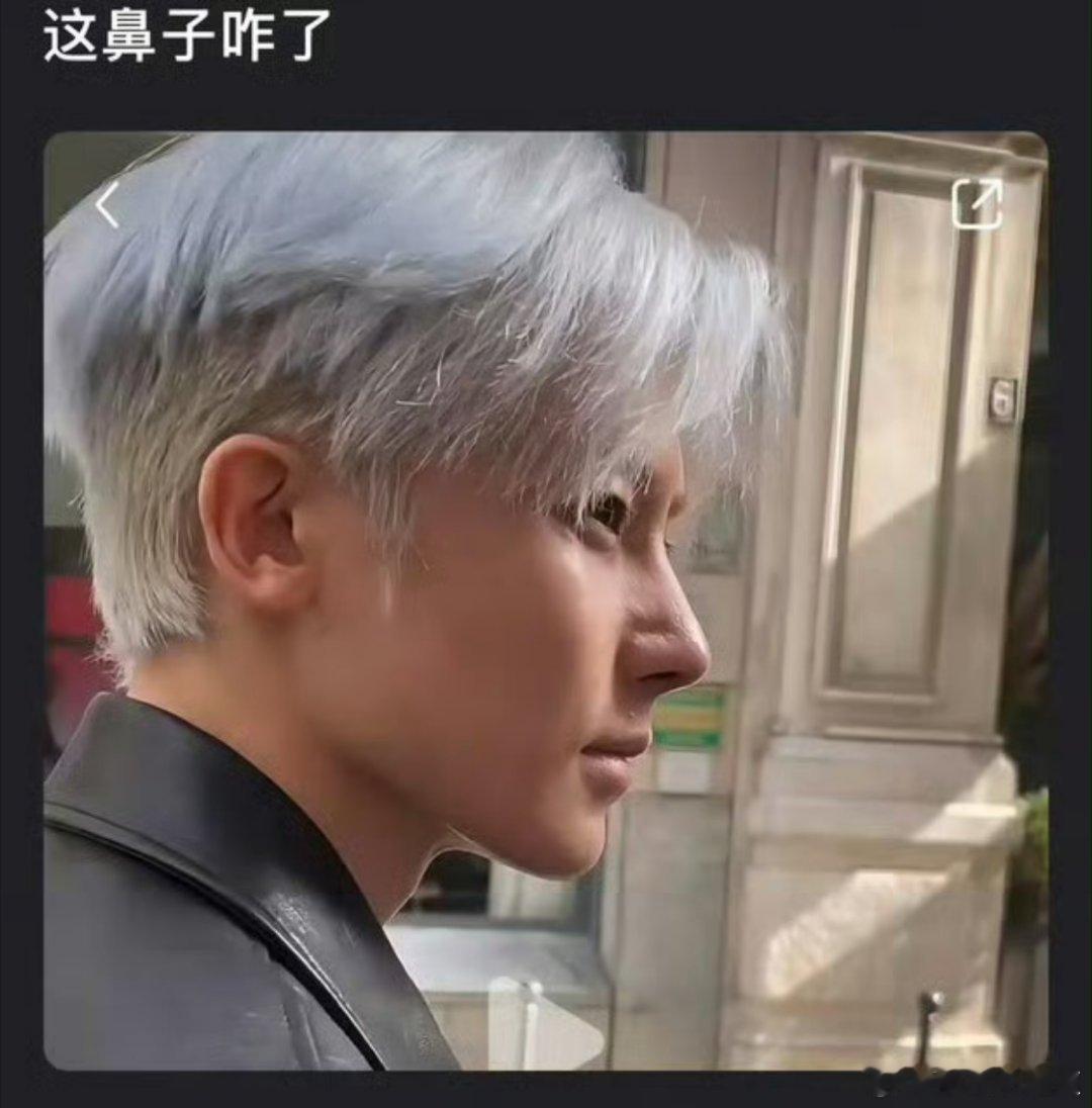 侯明昊这鼻子？是什么情况啊怎么拍出的图片是这样的？ 