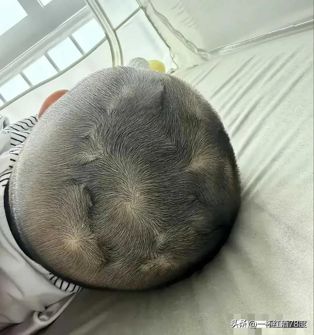 对这种脑袋，民间有一套固定的定义，一旋横，二旋愣，三旋四旋打架不要命，五旋六旋拉