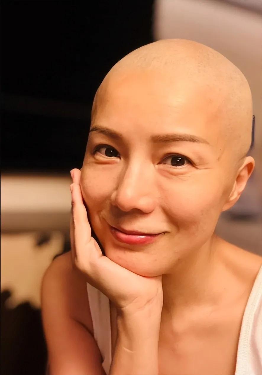 51岁的港姐吴文忻，曾经在舞台上光彩照人，如今却被癌症晚期折磨得苦不堪言。她自曝