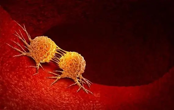 不怕刀、不怕药、不怕烧，癌细胞现在怕“被点名”。斯坦福大学团队开发的STING激