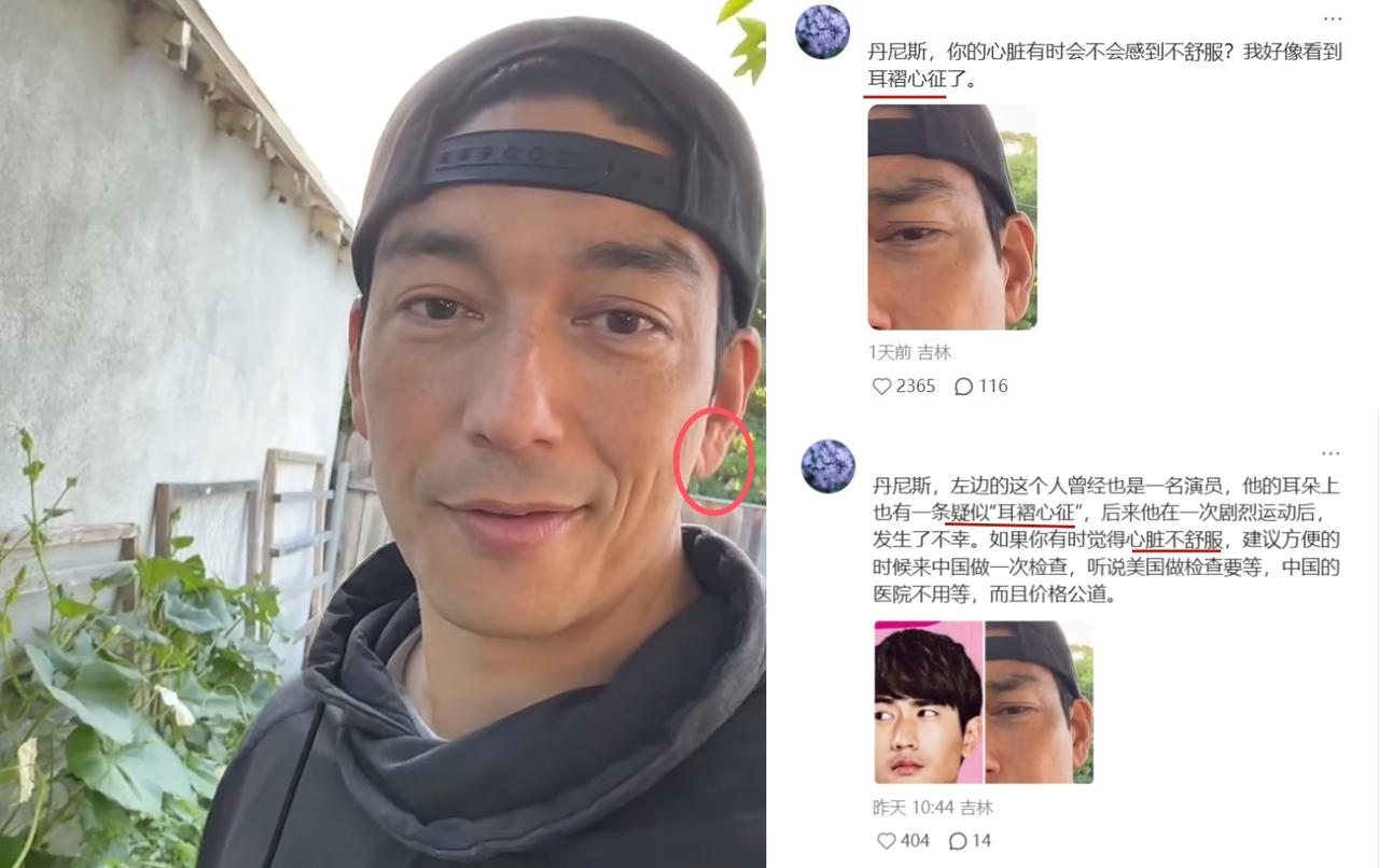 43岁男星耳垂疑似“耳褶心征”，网友：快去查心脏！
近期，丹尼斯·吴，罕见发视频