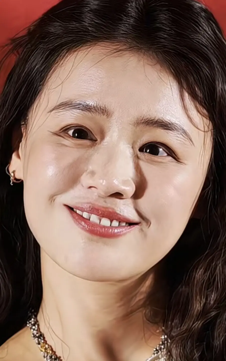 马思纯，眼睛是怎么回事