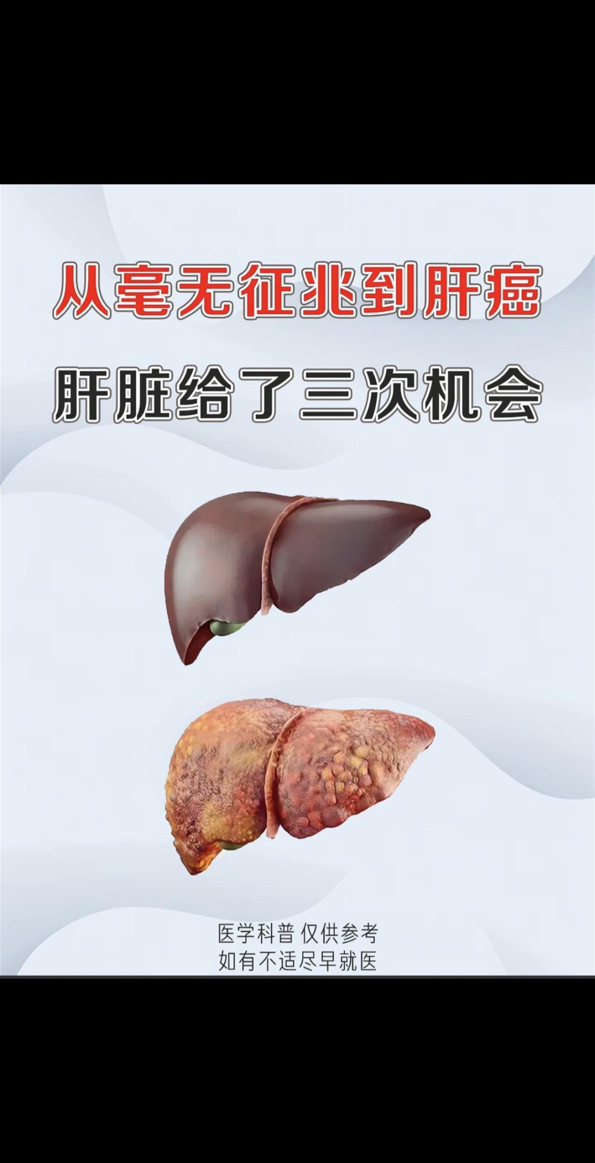 乙肝 乙肝小知识科普 医学科普