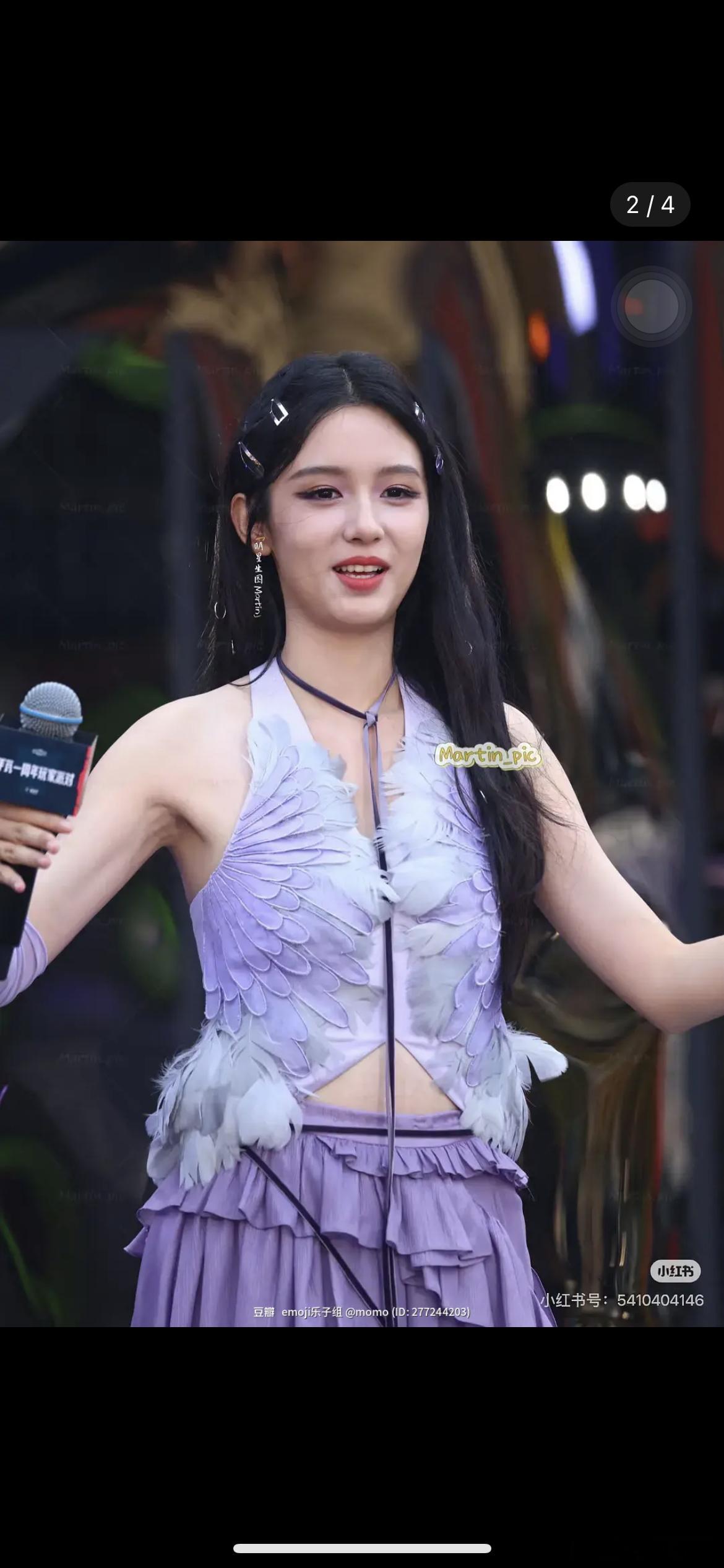 周也这面部状态还有救吗 