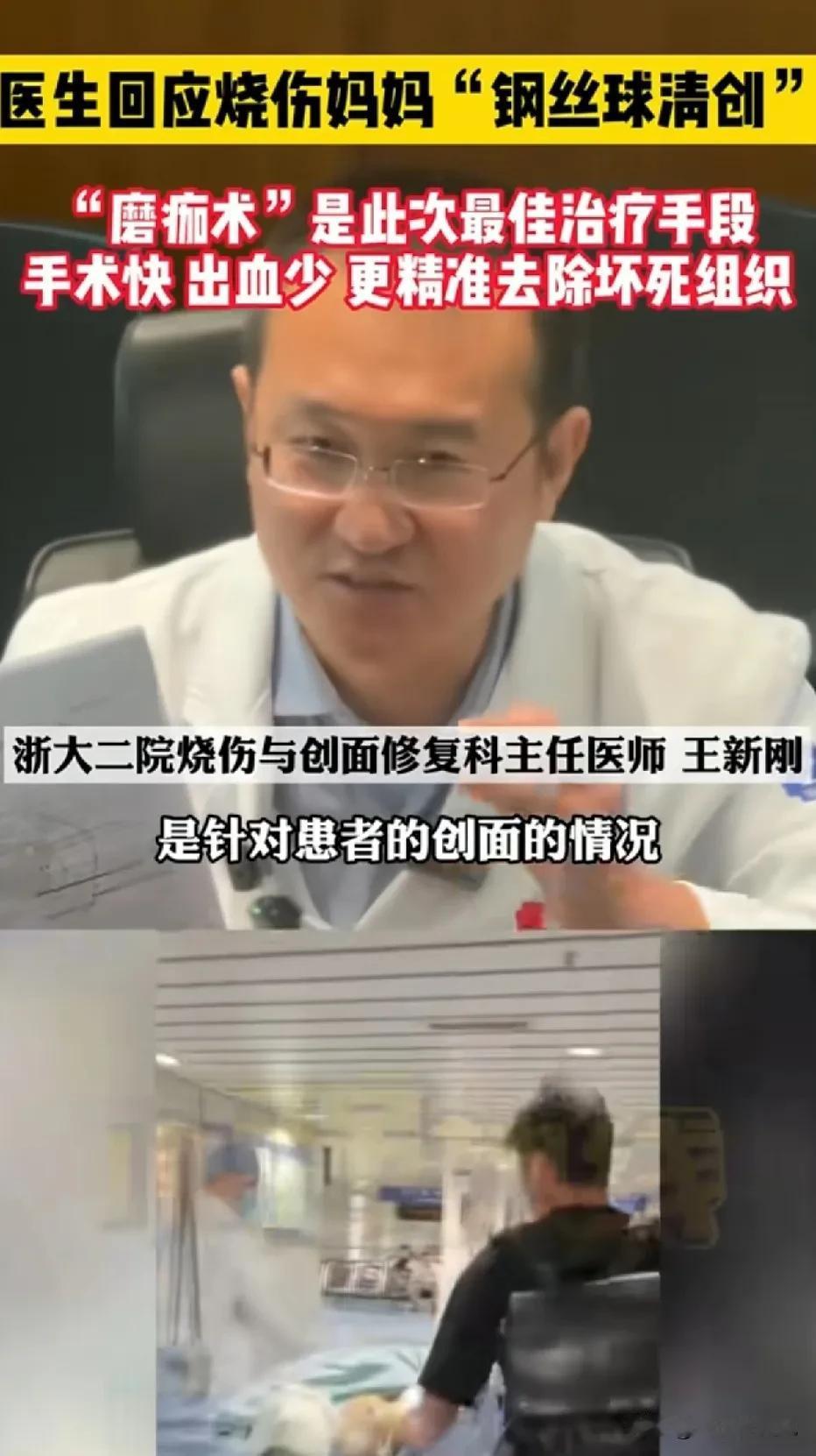 烧伤妈妈的治疗方案来了！医生回应说，用金属丝球，配合磨削器处理伤口，被称之为“磨