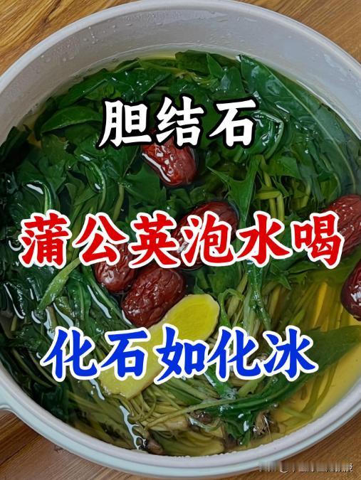 胆结石，蒲公英泡水喝

胆结石，这一常见于体检报告的疾病，其成因并不复杂。从现代