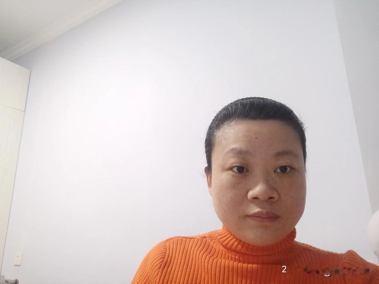 羡慕别人月经量少就两三天，子宫肌瘤中度贫血，害怕手术
一直都非常羡慕人家那月经量