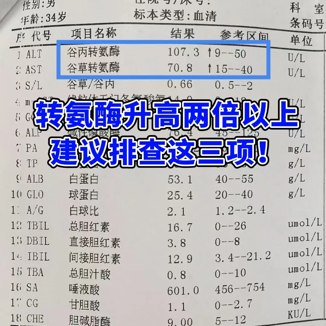 肝功能转氨酶这一项指标如果升高超过两倍，也就是到达80以上，说明肝细胞...