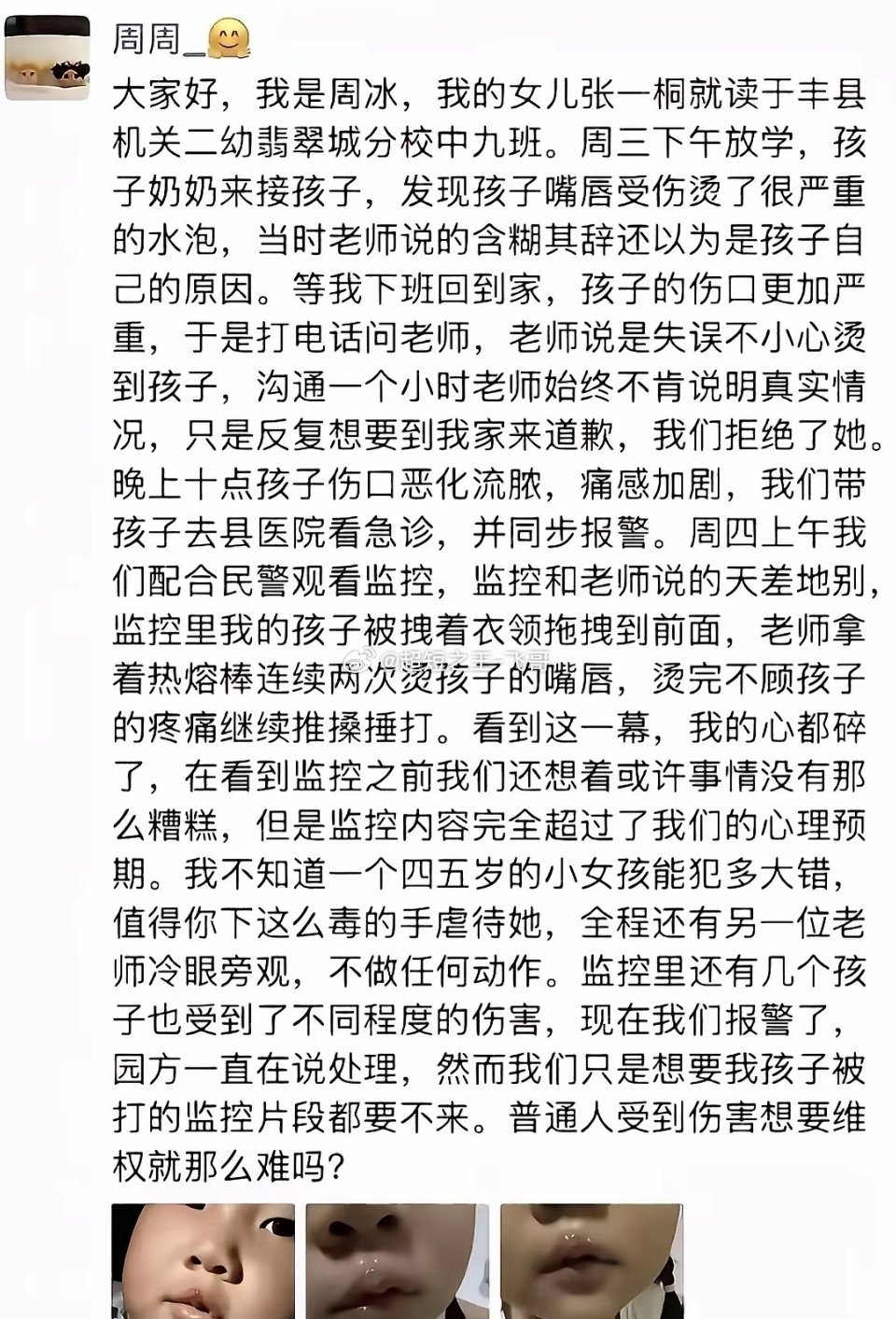 对于热熔胶烫嘴的事，这三方都要受罚，一个都不能漏。第一，涉事的那个女幼师，她应该