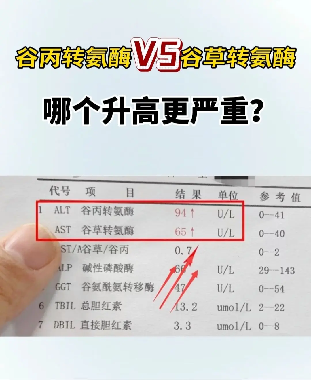 都是转氨酶但是谷丙和谷草的升高各有不同！以谷丙转氨酶升高为主，谷草指标...