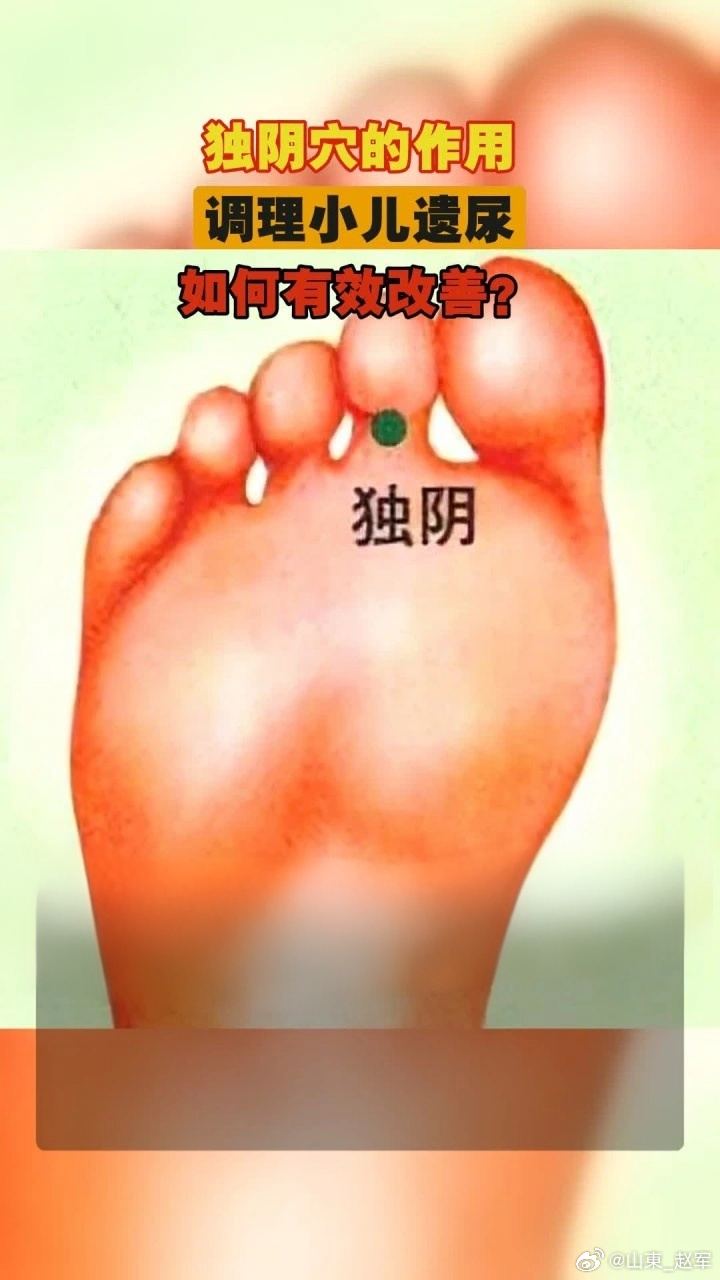 一、独阴穴（经外奇穴）- 定位：足第2趾跖侧（足底）远端趾间关节横纹中点，左右各
