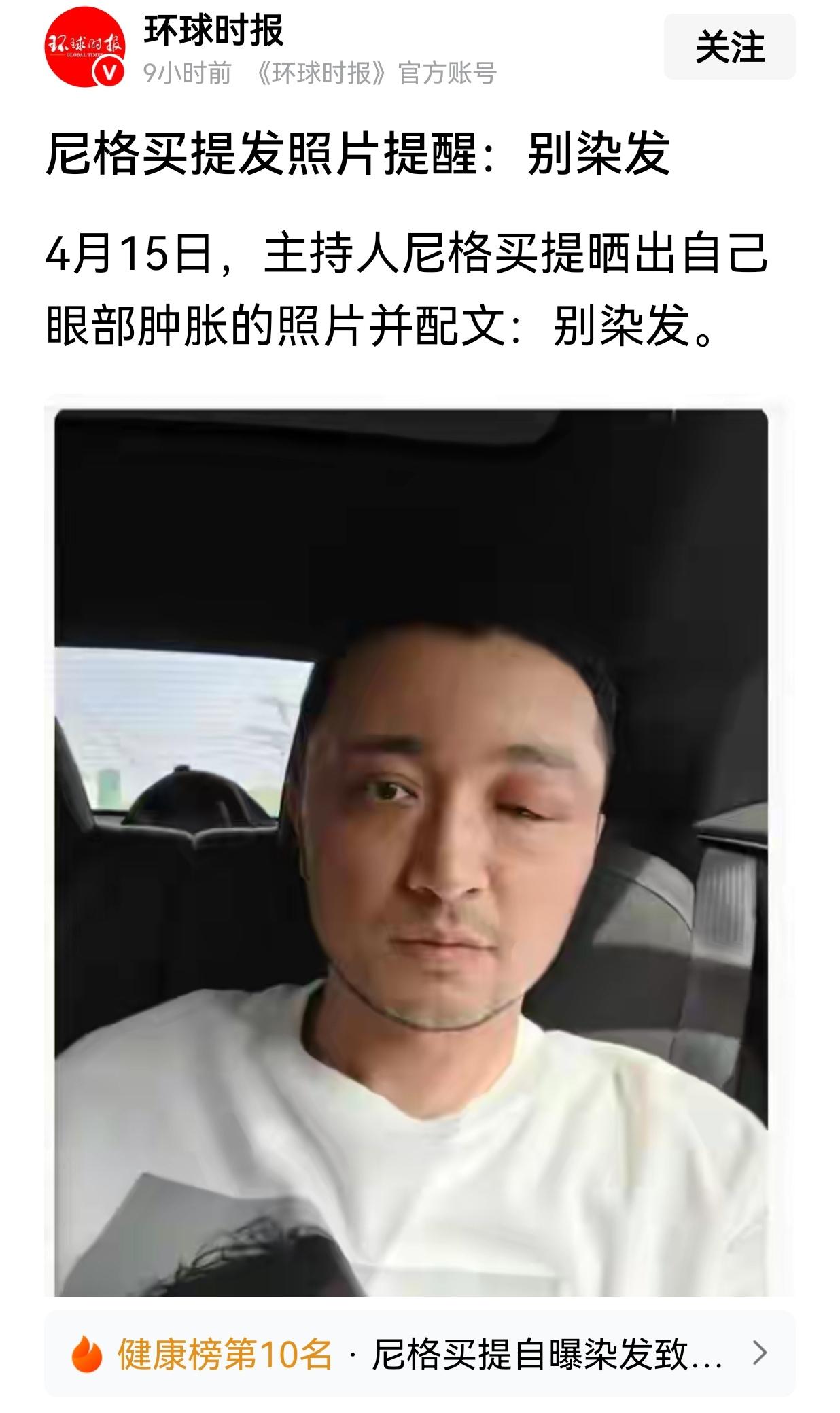 套话:染发有风险、染发需谨慎！

前央视主持人尼格买提4月15日晒出自己眼部肿胀