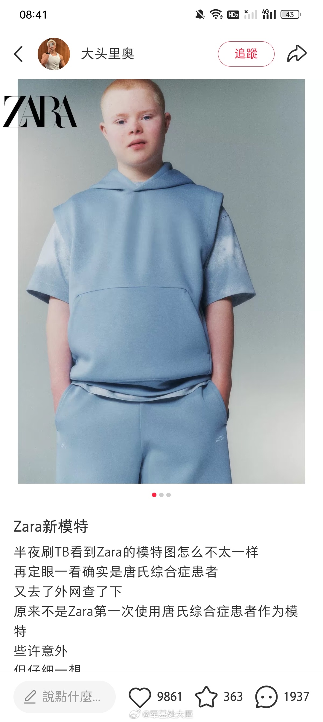 Zara的唐氏儿模特。国外的月亮还真是圆。在此地【唐】早已成了高频网络骂人用语，
