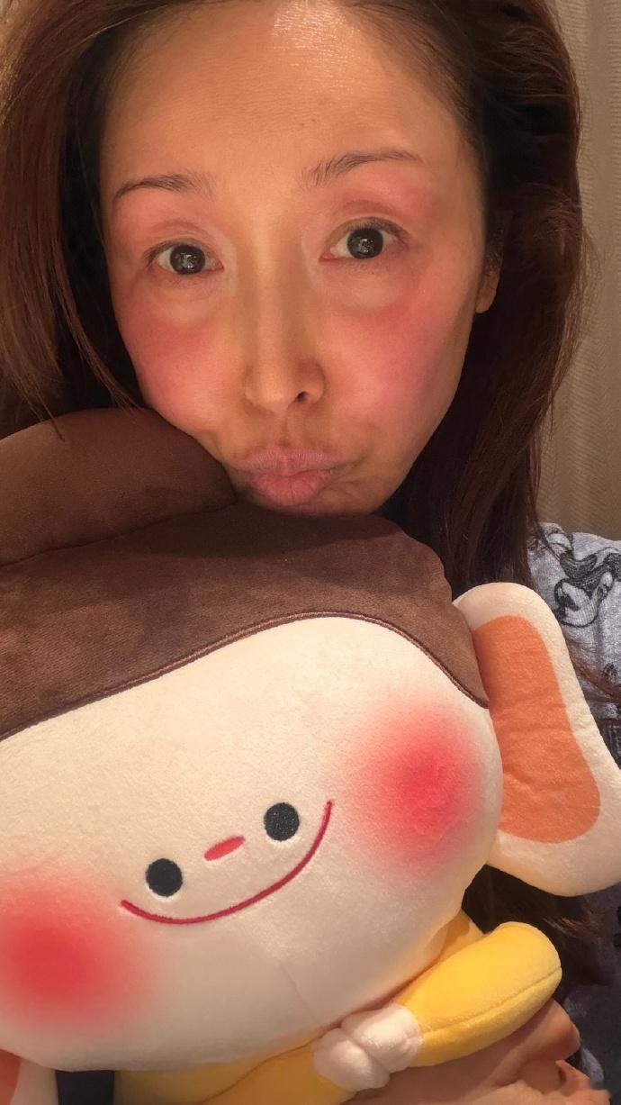 孙悦冻伤成佛小伴春晚舞台的精彩背后，是孙悦在低温中咬牙坚持的身影，冻伤的脸庞藏着