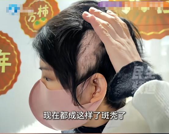 “悲剧还是发生了！”河南，一女子在美容院的推销下，往头皮打了玻尿酸，在注射过程中