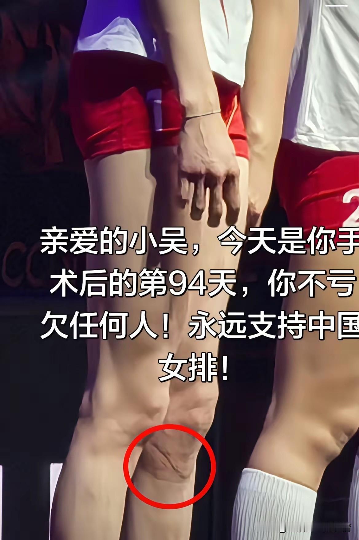 没有吴梦洁的中国女排世联赛3：2泰国，有吴梦洁的亚锦赛2：3泰国，不是刁琳宇可能