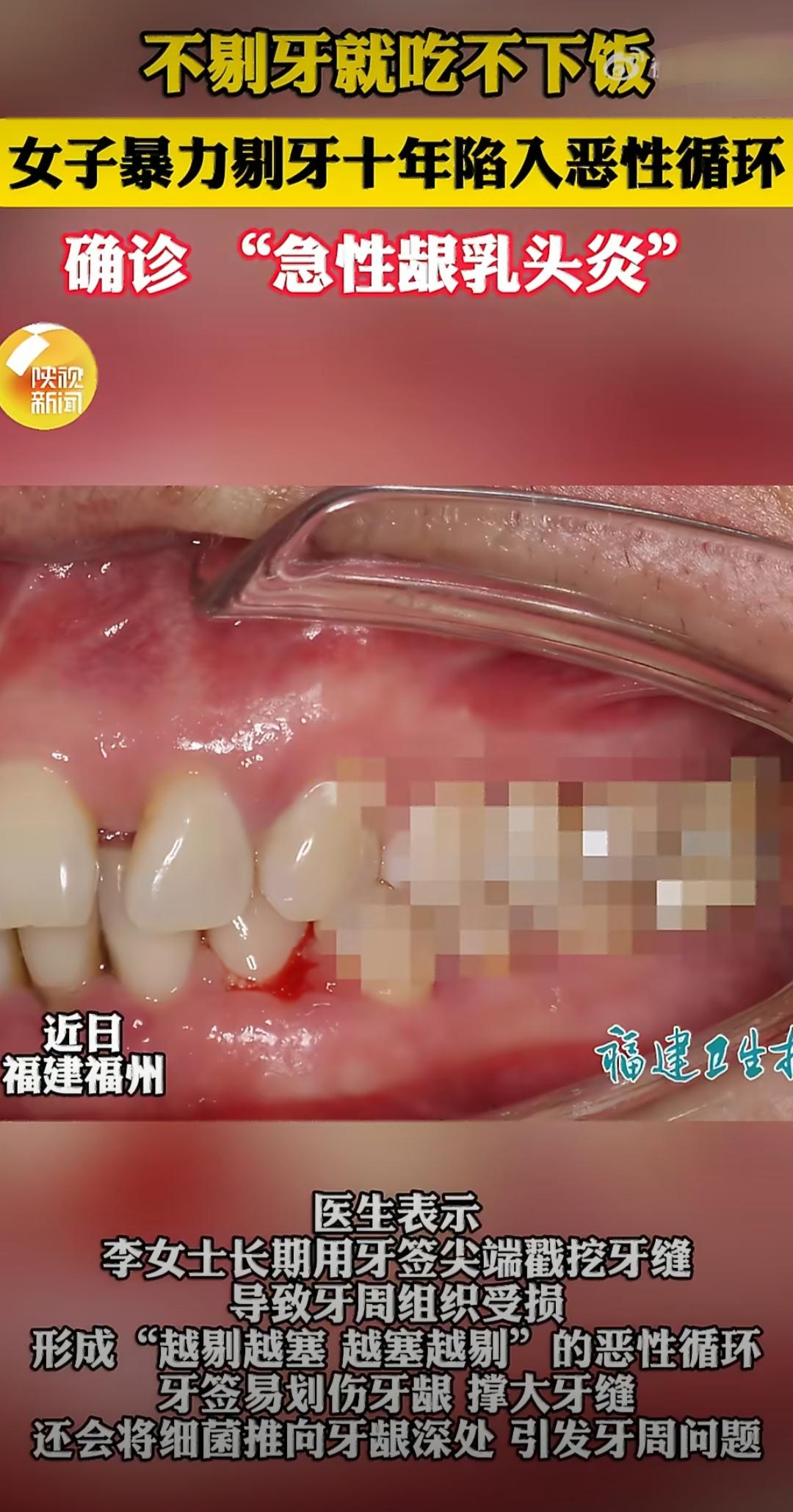 福建福州的李女士有个坚持了十年的习惯，就是饭后必须用牙签剔牙，不然总觉得嘴里不舒