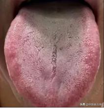 比肾虚更可怕的是肝郁脾虚，补不到地方，吃多少六味地黄丸都白搭

主诉：力不从心、
