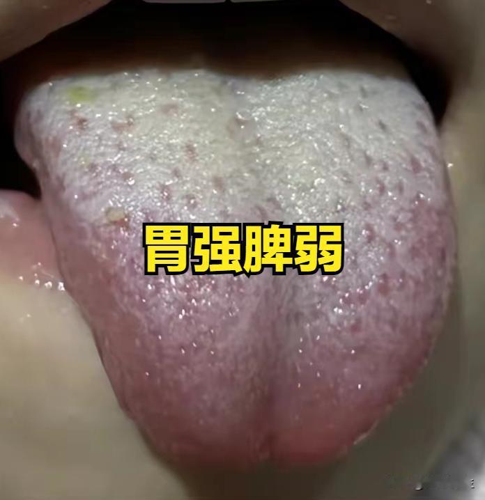 劳动节这才几天，有些朋友就把身体吃成这样了，火锅烧烤啤酒就先戒一下吧

主诉：腹