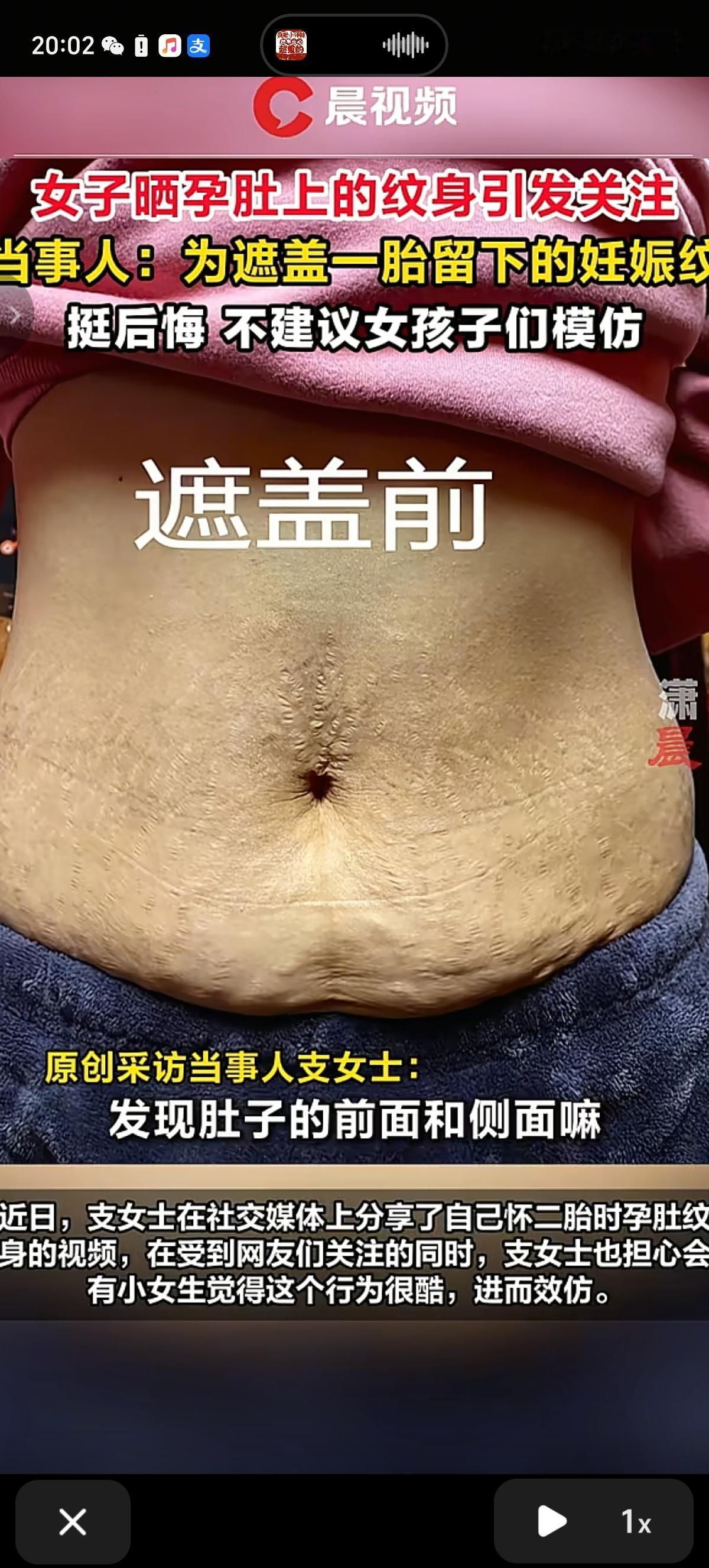 妊娠纹很丑吗？大家觉得有妊娠纹该不该纹身呢，纹身之后更美丽还是保留妊娠纹更好呢？