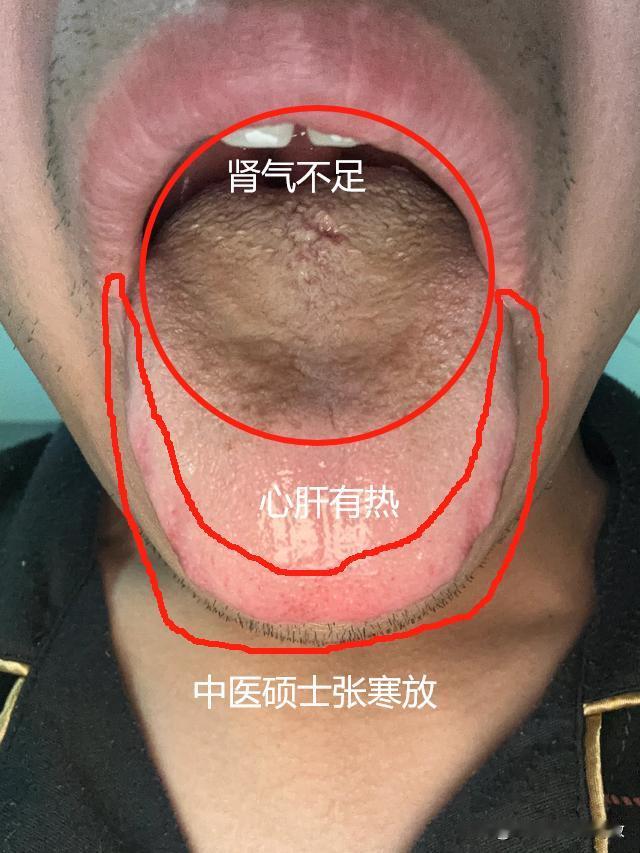 我真好奇，你晚上干啥去了，能把肾亏成这样[捂脸][捂脸][捂脸]
亏成你这样的，