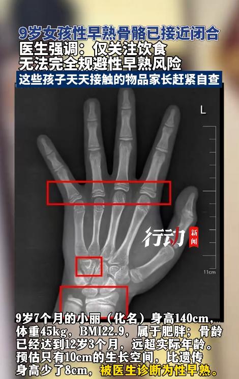 “情况有些棘手！”8月4日，齐鲁频道报道，广东东莞一名9岁多的女孩身高约1.4米